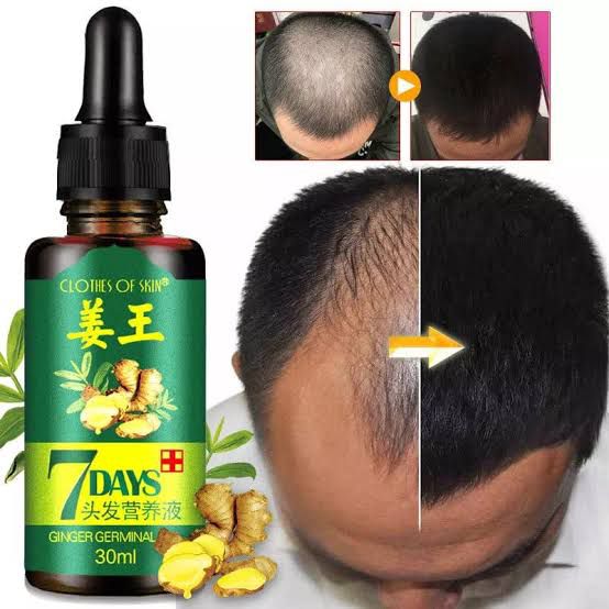 7 Days Hair Growth Germinal Serum Oil (30ML) ValueKartPk