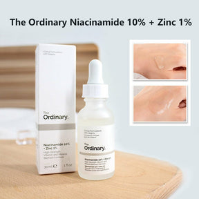 The Ordinary Niacinamide 10% + Zinc 1 % (30ML ) ValueKartPk