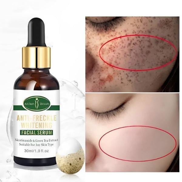 Aichun Anti Freckle Whitening Facial Serum 30ml ValueKartPk